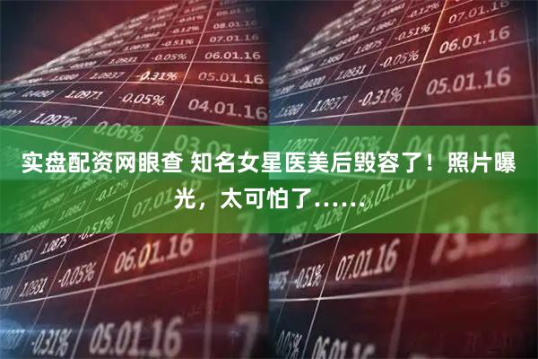 实盘配资网眼查 知名女星医美后毁容了！照片曝光，太可怕了……